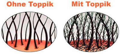 Grafik - Der Toppik-Effekt